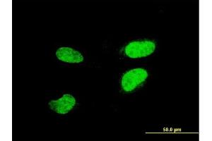 Immunofluorescence of monoclonal antibody to ATF2 on HeLa cell. (ATF2 anticorps  (AA 1-209))