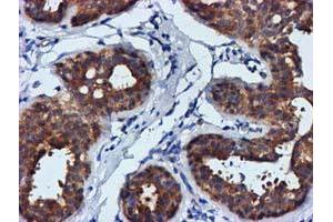 Immunohistochemical staining of paraffin-embedded Human breast tissue using anti-FGFR2 mouse monoclonal antibody. (FGFR2 anticorps)