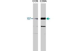 Rbl1 monoclonal antibody, clone KAB6  recognizes both the phosphorylated and unphosphorylated forms of p107 at 107kDa. (p107 anticorps)