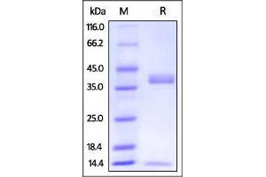 Biotinylated Cynomolgus / Rhesus macaque FcRn / FCGRT & B2M on SDS-PAGE under reducing (R) condition.