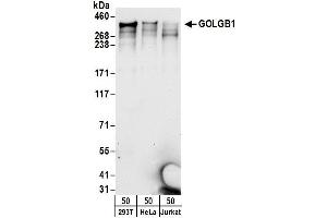 anti-Golgin B1 (GOLGB1) (AA 950-981) antibody