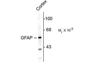 Image no. 1 for anti-Glial Fibrillary Acidic Protein (GFAP) antibody (ABIN372651) (GFAP anticorps)
