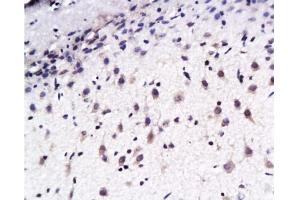 Immunohistochemistry (Paraffin-embedded Sections) (IHC (p)) image for anti-EPH Receptor B2 (EPHB2) (AA 551-650) antibody (ABIN730708)