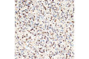 Immunohistochemistry of paraffin-embedded human spleen using SHIP11 Rabbit mAb (ABIN7267882) at dilution of 1:100 (40x lens). (INPP5D anticorps)