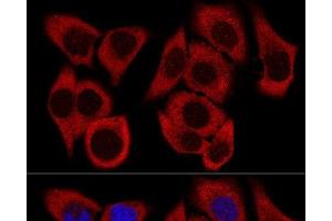 Confocal immunofluorescence analysis of HeLa cells using RPL36 Polyclonal Antibody at dilution of 1:200. (RPL36 anticorps)