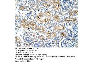 Rabbit Anti-MIF4GD Antibody  Paraffin Embedded Tissue: Human Kidney Cellular Data: Epithelial cells of renal tubule Antibody Concentration: 4. (MIF4GD anticorps  (C-Term))