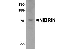 Western blot analysis of NIBRIN in mouse lung tissue lysate with NIBRIN antibody at 1 µg/mL. (Nibrin anticorps  (C-Term))