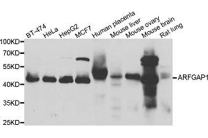 Western blot analysis of extracts of various cell lines, using ARFGAP1 antibody. (ARFGAP1 anticorps)