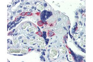 Anti-ZNF71 antibody IHC of human placenta. (ZNF71 anticorps  (C-Term))