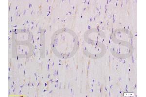 Formalin-fixed and mouse heart tissue labeled with Anti-SOD2 Polyclonal Antibody, Unconjugated (ABIN737361) at 1:200 followed by conjugation to the secondary antibody and DAB staining