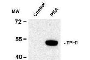 Image no. 1 for anti-Tryptophan Hydroxylase 1 (TPH1) (pSer58) antibody (ABIN372732) (Tryptophan Hydroxylase 1 anticorps  (pSer58))