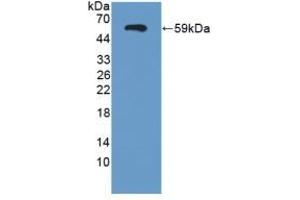 Detection of Recombinant SEMA3E, Human using Polyclonal Antibody to Semaphorin 3E (SEMA3E) (SEMA3E anticorps  (AA 32-516))