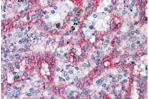 Human Spleen: Formalin-Fixed, Paraffin-Embedded (FFPE)