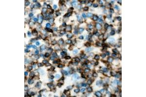 Immunohistochemical analysis of RELT staining in human lymph node formalin fixed paraffin embedded tissue section.