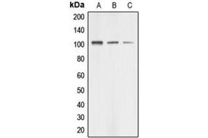 Western blot analysis of AASS expression in HUVEC (A), HeLa (B), HEK293T (C) whole cell lysates. (AASS anticorps  (Center))