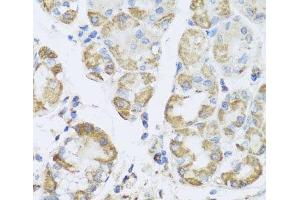 Immunohistochemistry of paraffin-embedded Human stomach using PRKAG1 Polyclonal Antibody at dilution of 1:100 (40x lens). (PRKAG1 anticorps)