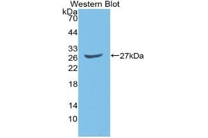 Western blot analysis of the recombinant protein. (GATA2 anticorps  (AA 117-338))