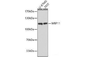Western blot analysis of extracts of various cell lines using WBP11 Polyclonal Antibody at dilution of 1:3000.