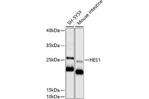 Western blot analysis of extracts of various cell lines, using HES1 antibody (ABIN6129271, ABIN6141726, ABIN6141728 and ABIN6215415) at 1:1000 dilution.