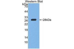 Western blot analysis of the recombinant protein. (PTPRS anticorps  (AA 889-1102))