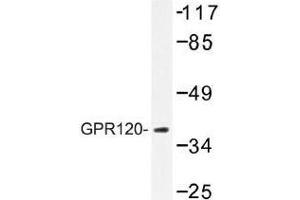 Image no. 1 for anti-omega-3 Fatty Acid Receptor 1 (O3FAR1) antibody (ABIN317737) (O3FAR1 anticorps)