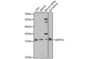 Western blot analysis of extracts of various cell lines, using AGPAT1 antibody. (AGPAT1 anticorps  (AA 204-283))