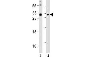 Western blot analysis of lysate from (1) mouse brain and (2) mouse skeletal muscle tissue lysate using Olig3 antibody at 1:1000. (OLIG3 anticorps  (N-Term))