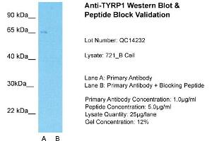 Host: Rabbit  Target Name: TYRP1  Sample Tissue: Human 721_BLane A:  Primary Antibody Lane B:  Primary Antibody + Blocking Peptide Primary Antibody Concentration: 1 µg/mL Peptide Concentration: 5.