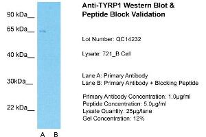 Host: Rabbit  Target Name: TYRP1  Sample Tissue: Human 721_BLane A:  Primary Antibody Lane B:  Primary Antibody + Blocking Peptide Primary Antibody Concentration: 1 µg/mL Peptide Concentration: 5. (Tyrosinase-Related Protein 1 anticorps  (Middle Region))