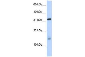 EIF1AX antibody used at 1 ug/ml to detect target protein. (EIF1AX anticorps  (Middle Region))