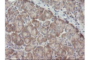 Image no. 5 for anti-ADP-Ribosylation Factor-Like 2 Binding Protein (ARL2BP) antibody (ABIN1496715)