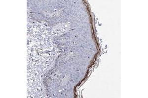 Immunohistochemical staining of human skin with HRNR polyclonal antibody  shows distinct positivity in granular layer cells. (HRNR anticorps)