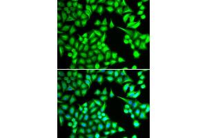 Immunofluorescence analysis of HeLa cell using IL21 antibody.
