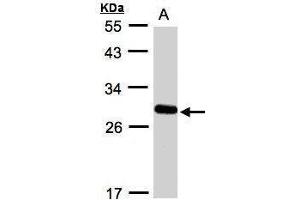 Western blot analysis of 30 ug whole cell lysate (A:A431) using a 12 % SDS PAGE gel and YIPF4 antibody at a dilution of 1:1000 (YIPF4 anticorps)
