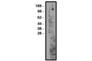 Image no. 1 for anti-Sphingomyelin Phosphodiesterase 3 (SMPD3) antibody (ABIN793721) (SMPD3 anticorps)
