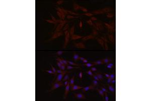 Immunofluorescence analysis of PC-12 cells using TYK2 Rabbit pAb (ABIN3022987, ABIN3022988, ABIN3022989 and ABIN6219333) at dilution of 1:150 (40x lens).