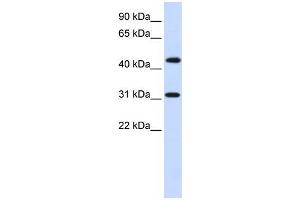 Human Brain; WB Suggested Anti-ZNF684 Antibody Titration: 0. (ZNF684 anticorps  (N-Term))