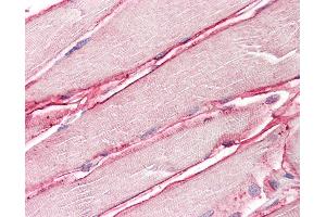 Anti-SGCD / Delta-Sarcoglycan antibody IHC of human skeletal muscle. (SGCD anticorps  (AA 244-256))