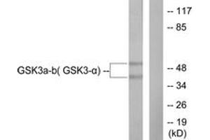 Western blot analysis of extracts from 293 cells, treated with TNF-a 20ng/ml 30', using GSK3 alpha/beta (Ab-279/216) Antibody. (GSK3 alpha/beta anticorps  (AA 246-295))