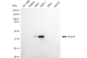 Western blotting analysis using HLA-B antibody (ABIN7799323).