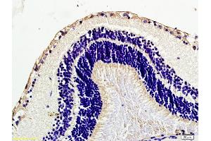 Formalin-fixed and paraffin embedded mouse eye labeled with Anti Caveolin-1 Polyclonal Antibody, Unconjugated (ABIN686752) at 1:200 followed by conjugation to the secondary antibody and DAB staining.