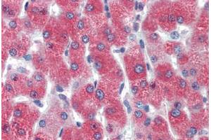 Human Liver (formalin-fixed, paraffin-embedded) stained with DBP antibody ABIN462166 followed by biotinylated goat anti-rabbit IgG secondary antibody ABIN481713, alkaline phosphatase-streptavidin and chromogen.