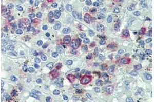 Human Spleen: Formalin-Fixed, Paraffin-Embedded (FFPE)