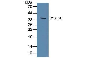 Detection of DKK1 in Porcine Brain Tissue using Polyclonal Antibody to Dickkopf Related Protein 1 (DKK1) (DKK1 anticorps  (AA 33-266))