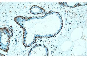 Immunohistochemistry (IHC) image for anti-Annexin A5 (ANXA5) (AA 149-166), (Internal Region) antibody (ABIN7598805)