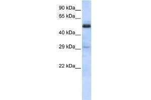 WB Suggested Anti-SCML1 Antibody Titration:  0. (SCML1 anticorps  (Middle Region))