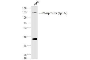 K562 lysates probed with Phospho-Bcr (Tyr177) Polyclonal Antibody, Unconjugated  at 1:300 dilution and 4˚C overnight incubation. (BCR anticorps  (pTyr177))