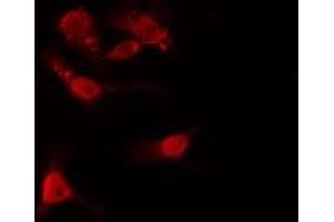ABIN6275452 staining  HeLa cells by IF/ICC. (IQGAP1 anticorps  (N-Term))