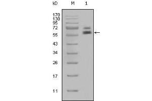 Western blot analysis using CK5 mouse mAb against Hela cell lysate (1). (Cytokeratin 5 anticorps)