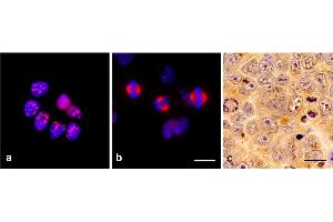 Immunocytochemistry of TPX2 using monoclonal antibody TPX2-01 in glioblastoma cell line T98G: a) interphase, b) mitosis.